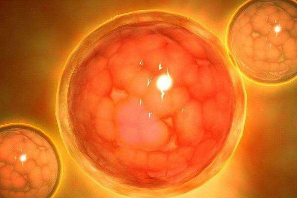 多囊卵巢綜合癥臨床表現有那些？