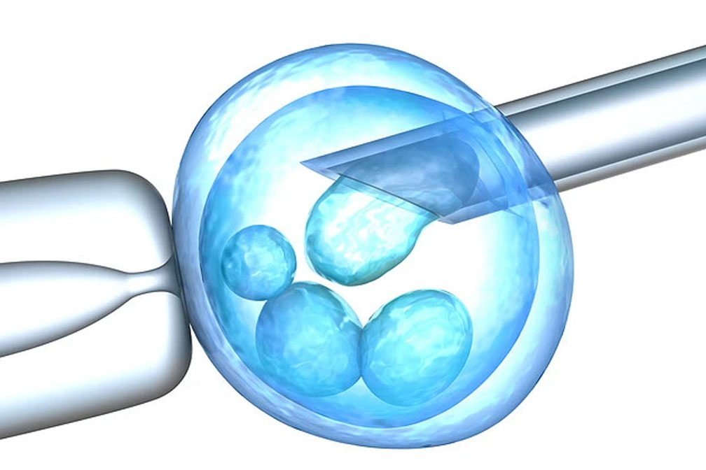 DHC帶你了解試管嬰兒整個流程個各個環節
