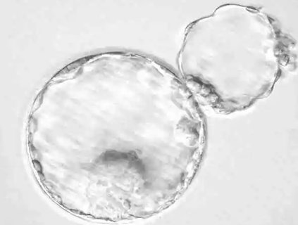 輔助孵化能提高成功率嗎？揭秘輔助孵化技術的影響