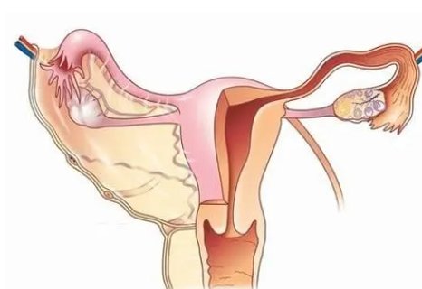 沒有輸卵管可以做試管嗎？試管嬰兒技術(shù)解決問題