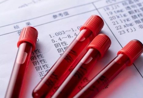 β人絨毛膜促性腺激素多少是懷孕？懷孕的標志